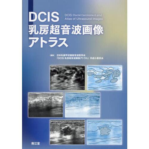 DCIS乳房超音波画像アトラス : 有隣堂ヤフーショッピング店 - 通販