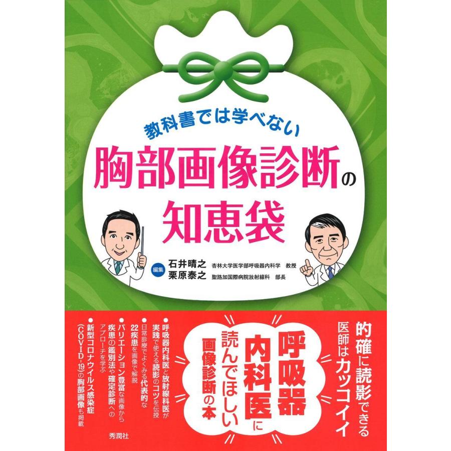 教科書では学べない胸部画像診断の知恵袋 : 有隣堂ヤフーショッピング店 - 通販 - Yahoo!ショッピング