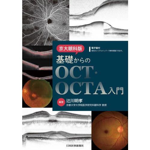 【未使用】専門医必携 眼科鑑別診断実力アップQ&A 専門医必携 眼科鑑別診断実力アップQ&A | 山田 昌和, 平塚 義宗 |本