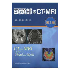 裁断済】頭頸部のCT・MRI 第3版 頭頚部のCT・MRI 第