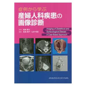 【美品】症例から学ぶ産婦人科疾患の画像診断 症例から学ぶ産婦人科疾患の画像診断 | 鳴海 善文, 髙濱 潤子