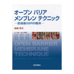 オープン バリア メンブレン テクニック