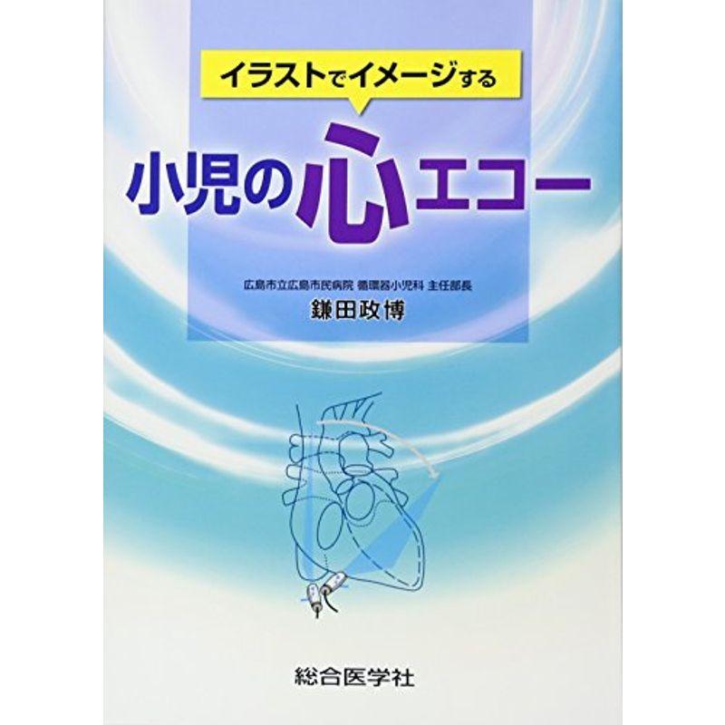 イラストでイメージする小児の心エコー us ゆるゆるストア 通販 Yahoo ショッピング