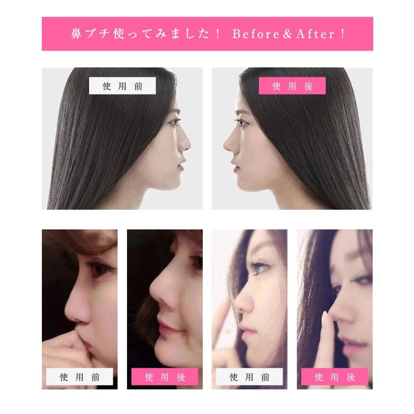 鼻プチ 効果 プチ整形 鼻メイク 鼻up 鼻のアイプチ 鼻を高くする方法 マジックノーズ 3サイズセット 美鼻スジ効果 アイテム 痛くない 激安 雑貨 8f04 Zakzak雑貨 通販 Yahoo ショッピング