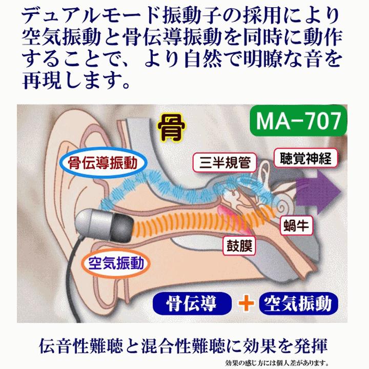 アネックス 【送料込み】ハイブリッド骨伝導 イヤホン式集音器 アネックス 【送料込み】ハイブリッド骨伝導 イヤホン式集音器