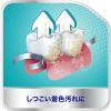 「入れ歯洗浄剤 部分用 ポリデント 99.9%除菌 108錠  1セット （3箱）Haleonジャパン」の商品サムネイル画像8枚目