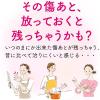 「アットノンEXジェル 小林製薬【第2類医薬品】」の商品サムネイル画像2枚目