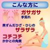 「メンソレータムやわらか素肌クリームU 90g ロート製薬 手指のあれ 角化症 乾燥 尿素20%クリーム【第3類医薬品】」の商品サムネイル画像3枚目