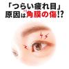 「【セール】スマイルザメディカルA DX コンタクト 15ml ライオン 乾き・角膜修復 疲労【第3類医薬品】」の商品サムネイル画像3枚目