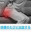 「「クラシエ」漢方乙字湯エキス錠 180錠 3箱セット クラシエ薬品 いぼ痔 きれ痔 便秘【第2類医薬品】」の商品サムネイル画像4枚目